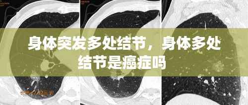 身体突发多处结节,身体多处结节是癌症吗