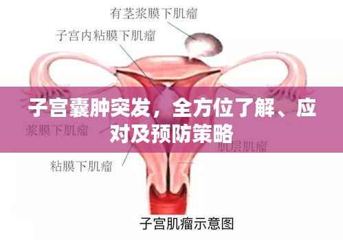子宫囊肿突发,全方位了解、应对及预防策略